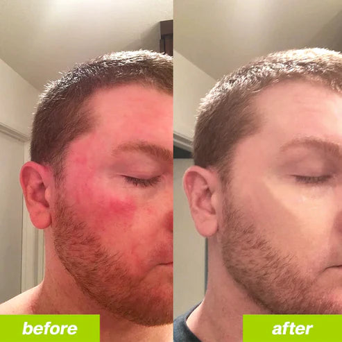 Hepra Restore - Liver Support