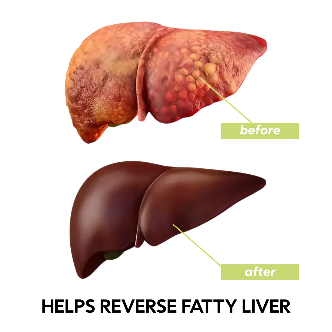 Hepra Restore - Liver Support